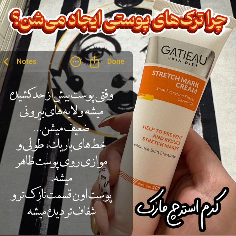 کرم رفع ترک های پوستی یا استرچ مارک گاتیو