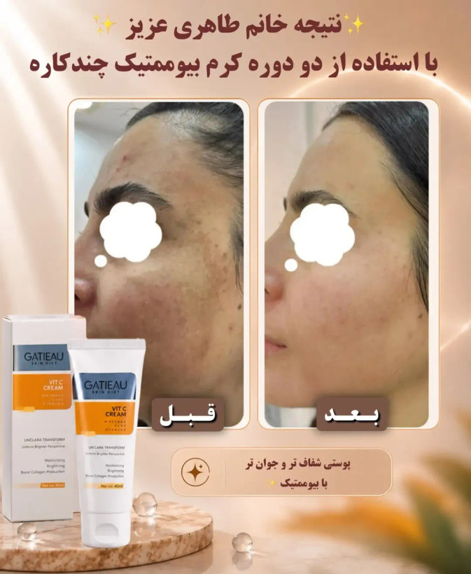 کرم بیوممتیک ویتامین C گاتیو