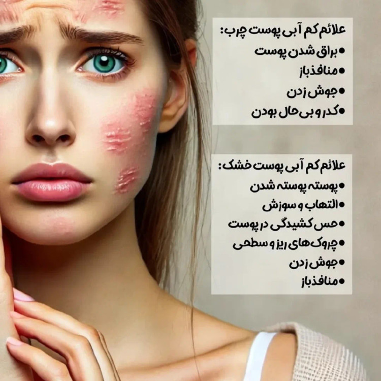 کرم بیوممتیک آبرسان پوست خشک و چرب گاتیو